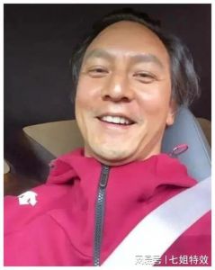 明星脱发真相_生发液到植发，内外兼修是关键