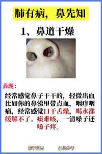 警惕_频繁吸鼻子背后的四种疾病