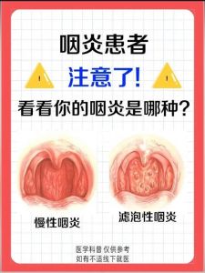 慢性咽炎歌手之路_揭秘治疗技巧与歌唱奥秘