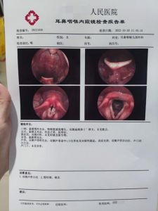揭秘喉咙哑原因及防治方法