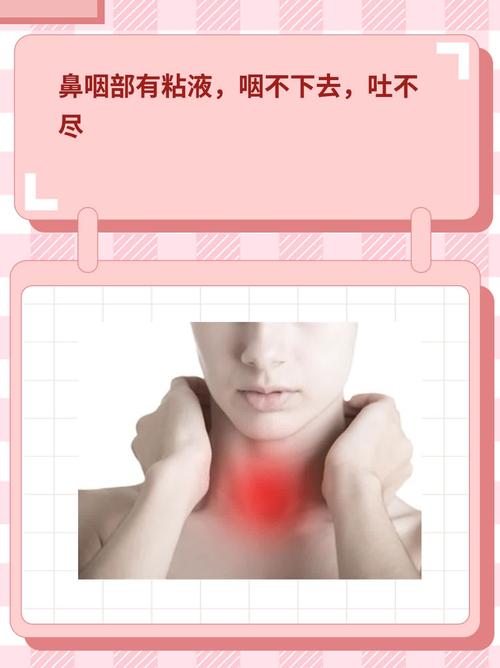鼻咽粘液困扰揭秘：慢性鼻炎咽炎应对攻略