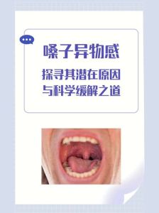 喉咙结节_声带与甲状腺结节真相及应对策略