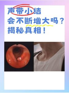 喉结变大生理病理交织之谜