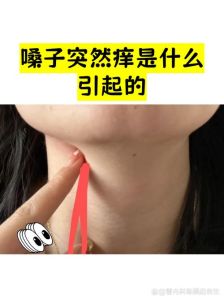 嗓子突然很痒像有毛毛_喉咙痒不停？查查是啥原因！