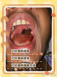 变声期把嗓子唱坏了_别瞎喊，科学方法保好嗓子
