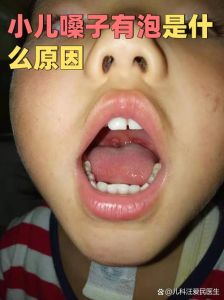 嗓子异物感_喉咙卡东西咳咽不出？查查咽炎鼻炎胃酸！