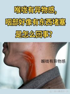 浑厚的嗓音是不是很难听_浑厚嗓音要自然，别假唱显难听