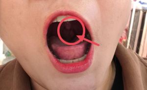 嗓音痒感觉有东西_喉咙老卡东西痒？感冒过敏胃酸都可能导致，这样调理能缓解