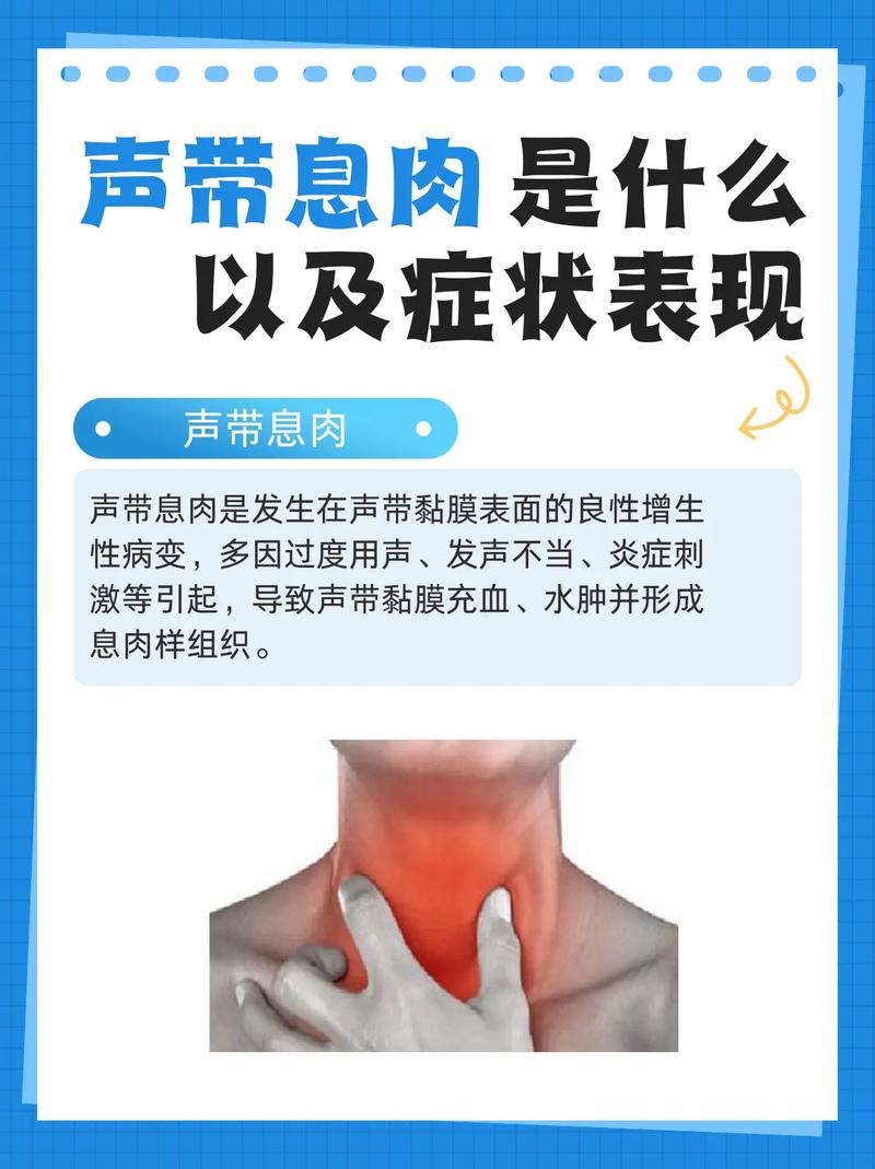 声带息肉手术会不会影响嗓音_声带息肉术后多久声音恢复？注意事项全知道