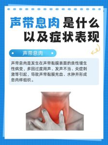 声带息肉手术会不会影响嗓音_声带息肉术后多久声音恢复？注意事项全知道